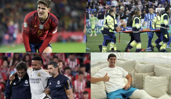 术难度极高 术难度极高